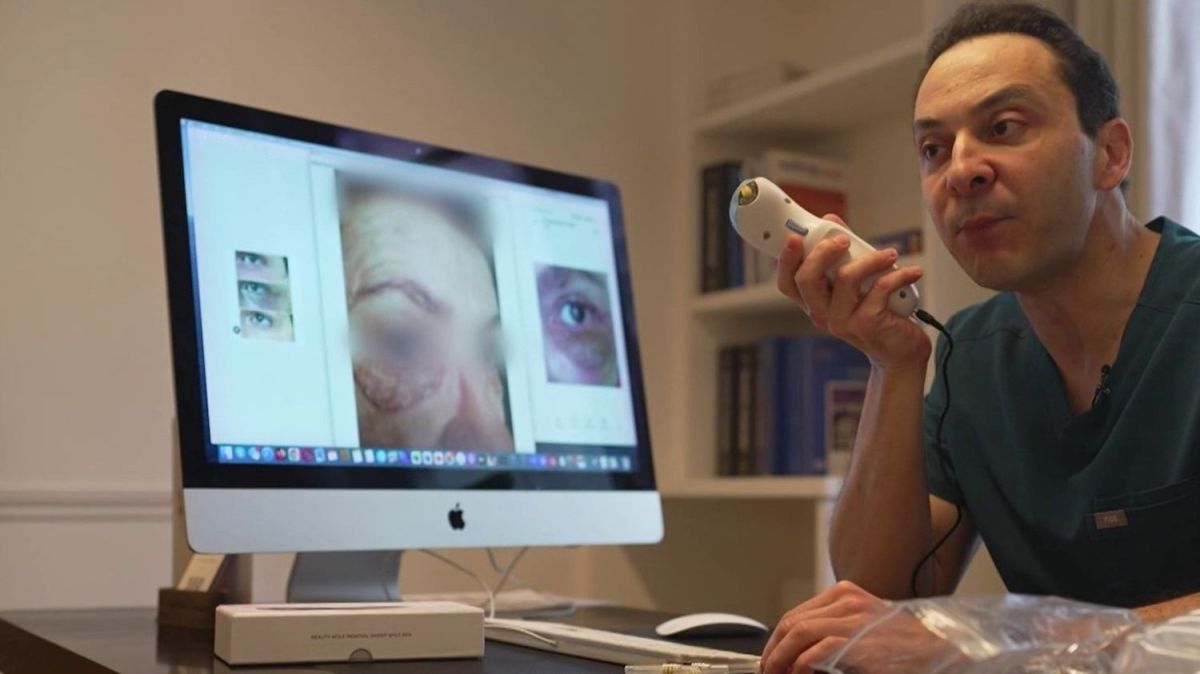 Les dangers du plasma pen : attention aux esthéticiennes non qualifiées