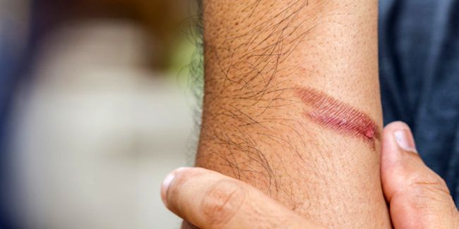 Grand-parent coupeur de feu : décryptage d'un don mystérieux