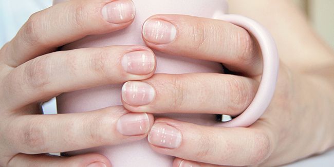 Les mystères des taches blanches sur les ongles : explications et conseils